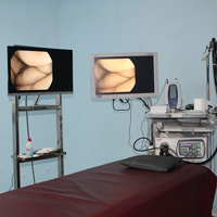 Endoscopy
