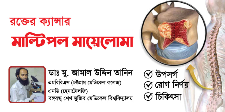 রক্তের রোগ মাল্টিপল মায়েলোমা