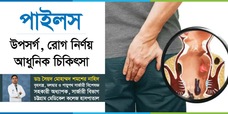 পাইলস কি, কারণ ও আধুনিক চিকিৎসা