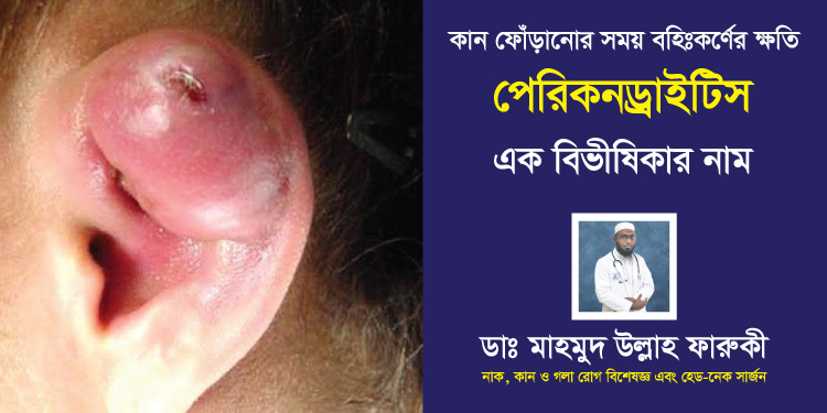 পেরিকনড্রাইটিস : এক বিভীষিকার নাম